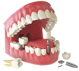 Dentipai Hero Image